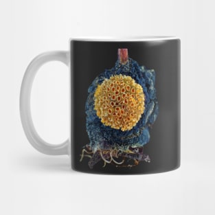 Rust fungus (Gymnosporangium sp.) under the microscope Mug